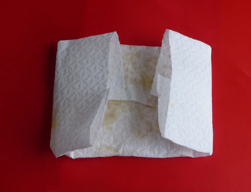 Topfenauflage, Topfenpatscherl als volksmed. Hilfe